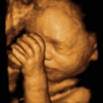 baby_model-21