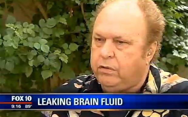 Man S Runny Nose Turns Out To Be Leaky Brain We Interrupt